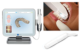マウスピース矯正:インビザライン