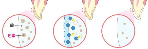 ホワイトニングメカニズム