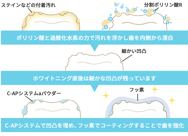 ハイブリッドポリリンホワイトニングシステム