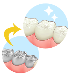 オールセラミックスについて